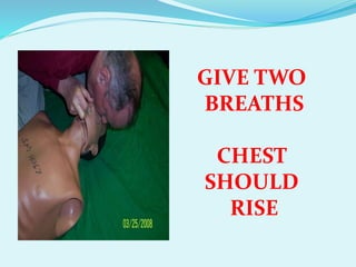GIVE TWO
BREATHS
CHEST
SHOULD
RISE
 