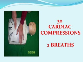 30
CARDIAC
COMPRESSIONS
2 BREATHS
 