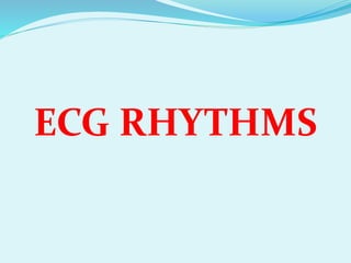 ECG RHYTHMS
 