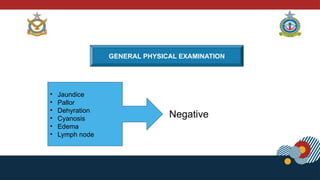 GENERAL PHYSICAL EXAMINATION
• Jaundice
• Pallor
• Dehyration
• Cyanosis
• Edema
• Lymph node
Negative
 