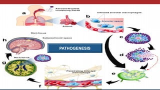 Pathogenesis
PATHOGENESIS
 