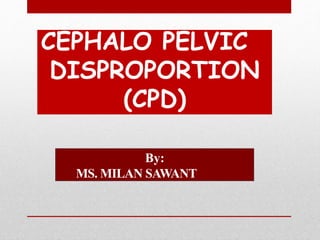 CEPHALO PELVIC
DISPROPORTION
(CPD)
By:
MS. MILAN SAWANT
 