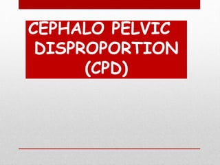 CEPHALO PELVIC
DISPROPORTION
(CPD)
 