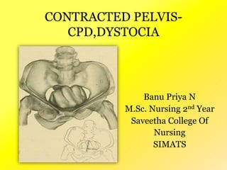 Banu Priya N
M.Sc. Nursing 2nd Year
Saveetha College Of
Nursing
SIMATS
CONTRACTED PELVIS-
CPD,DYSTOCIA
 