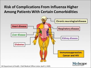 Flu (influenza) - Health