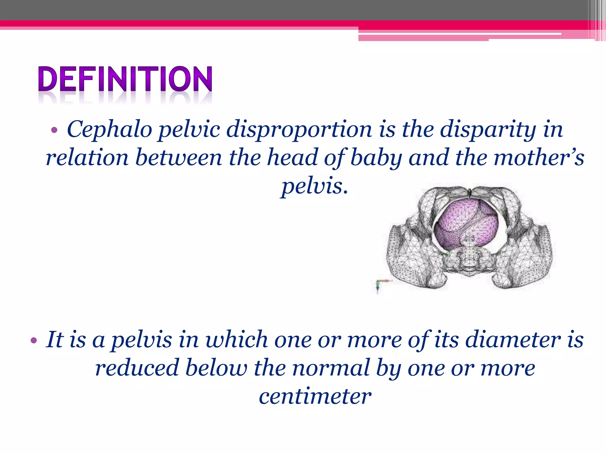 • Cephalo pelvic disproportion is the disparity in
relation between the head of baby and the mother’s
pelvis.

• It is a pelvis in which one or more of its diameter is
reduced below the normal by one or more
centimeter

 