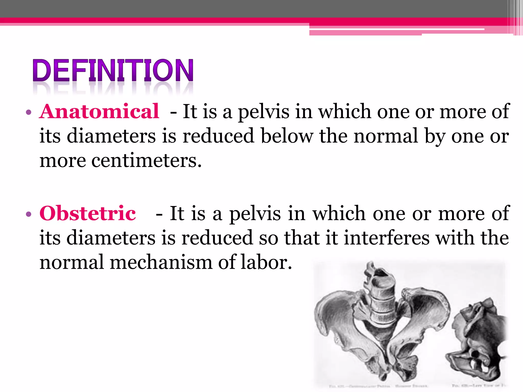• Anatomical - It is a pelvis in which one or more of
its diameters is reduced below the normal by one or
more centimeters.
• Obstetric - It is a pelvis in which one or more of
its diameters is reduced so that it interferes with the
normal mechanism of labor.

 