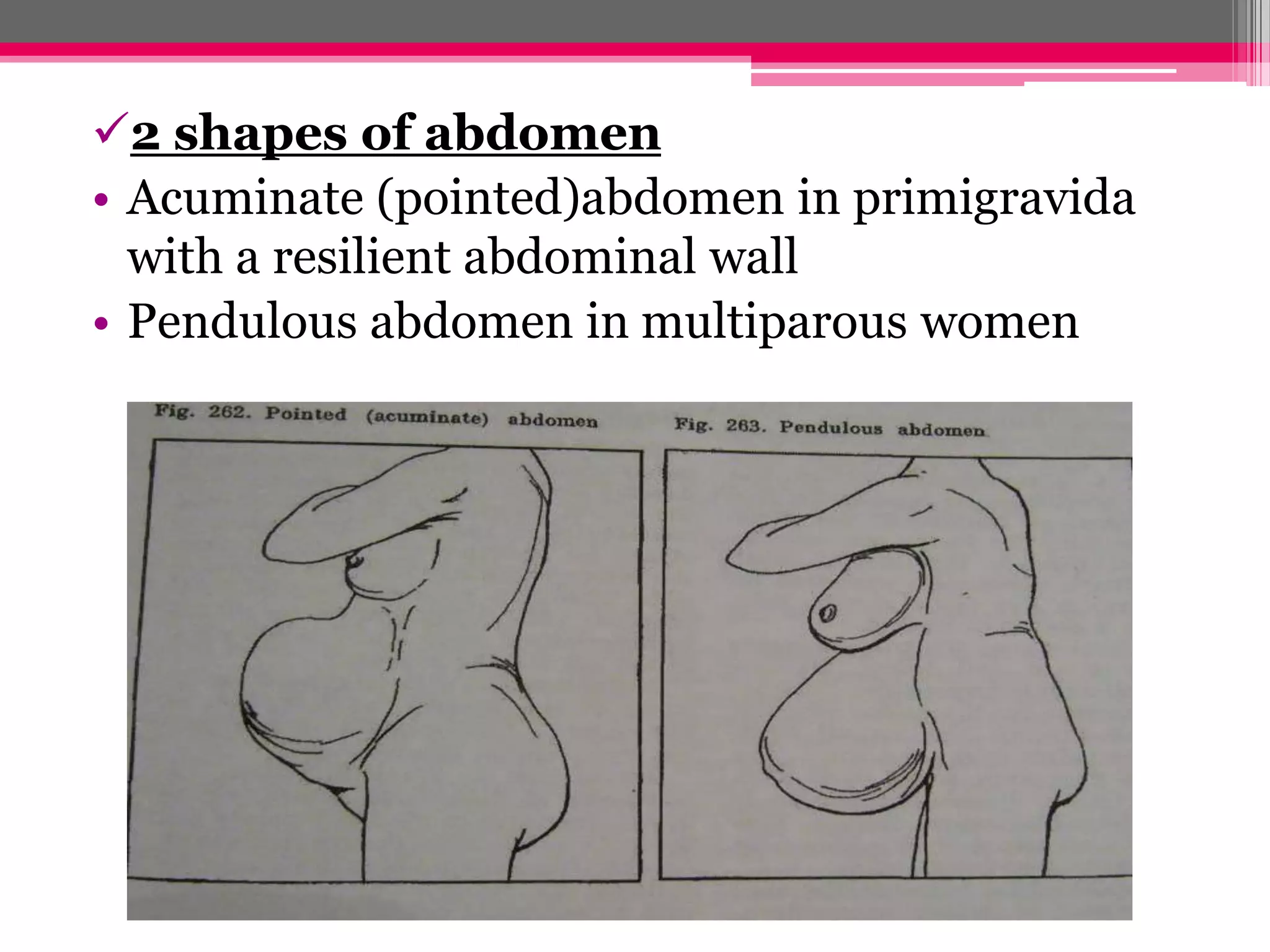 2 shapes of abdomen
• Acuminate (pointed)abdomen in primigravida
with a resilient abdominal wall
• Pendulous abdomen in multiparous women

 