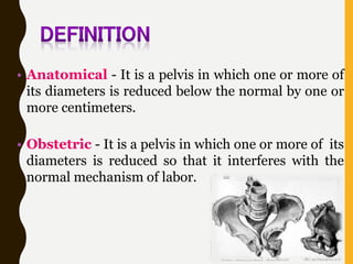 • Anatomical - It is a pelvis in which one or more of
its diameters is reduced below the normal by one or
more centimeters.
• Obstetric - It is a pelvis in which one or more of its
diameters is reduced so that it interferes with the
normal mechanism of labor.
 