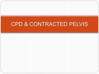 CPD & CONTRACTED PELVIS
 