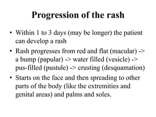 Progression of the rash
• Within 1 to 3 days (may be longer) the patient
can develop a rash
• Rash progresses from red and flat (macular) ->
a bump (papular) -> water filled (vesicle) ->
pus-filled (pustule) -> crusting (desquamation)
• Starts on the face and then spreading to other
parts of the body (like the extremities and
genital areas) and palms and soles.
 