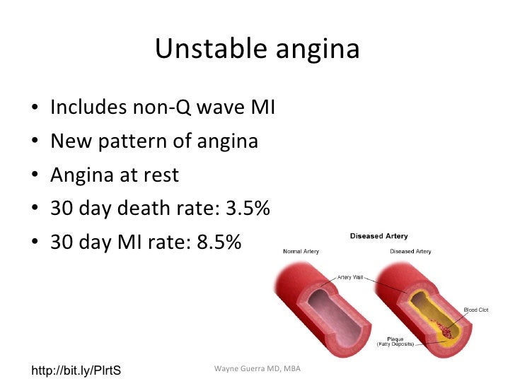 Chest Pain EMS Review