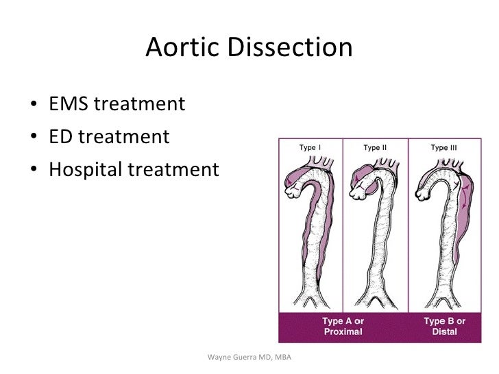 Chest Pain: EMS Review