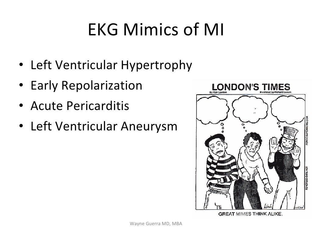 Chest Pain EMS Review