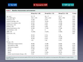B: Dynamic MR
A: No MR C: MR @ rest
 