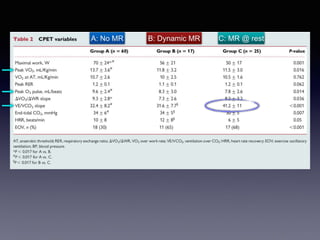 B: Dynamic MR
A: No MR C: MR @ rest
 