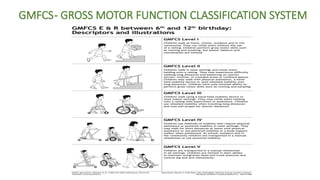 Cerebral palsy causing mental retardation. | PPTX