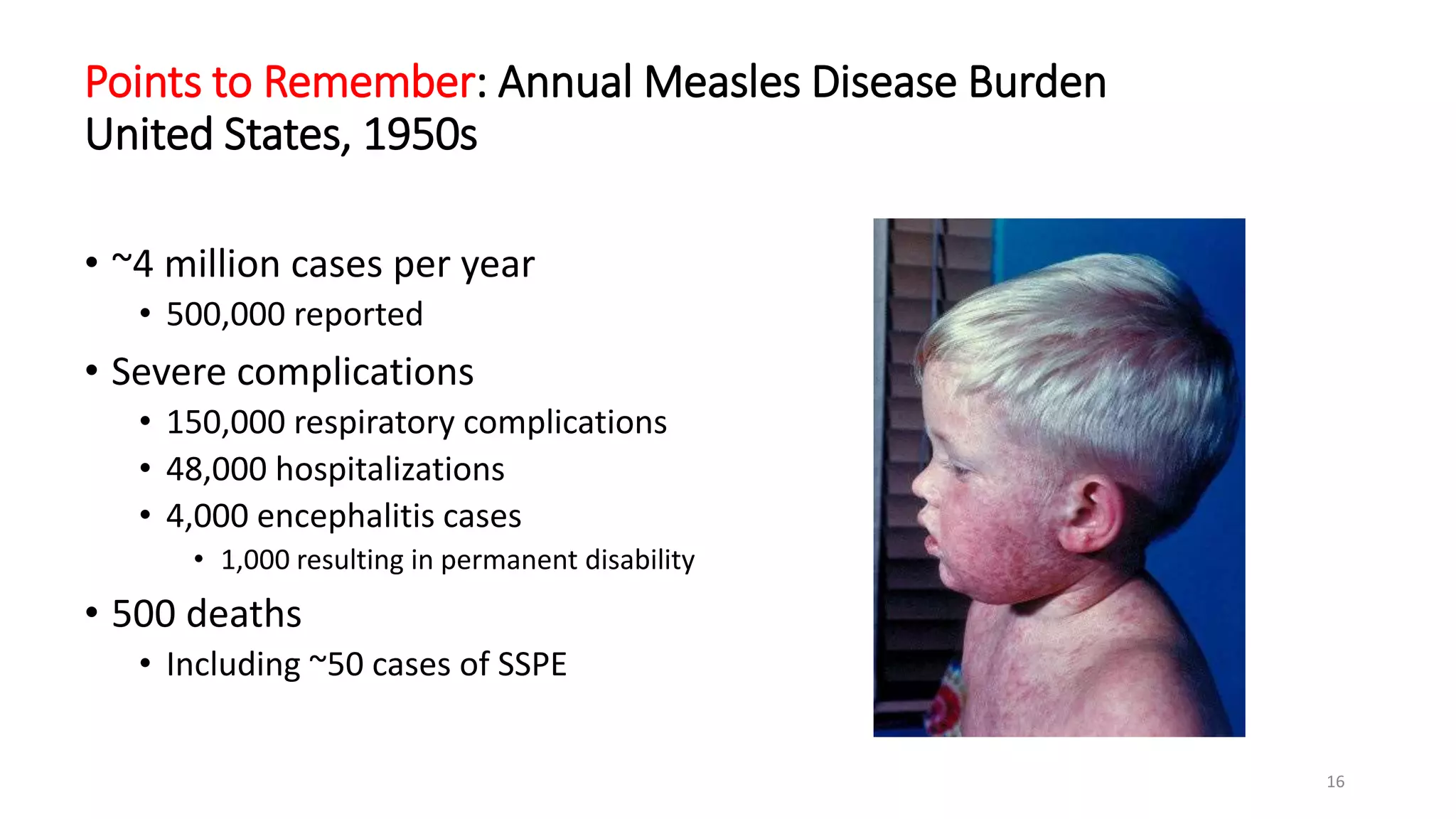 Points to Remember: Annual Measles Disease Burden
United States, 1950s
• ~4 million cases per year
• 500,000 reported
• Severe complications
• 150,000 respiratory complications
• 48,000 hospitalizations
• 4,000 encephalitis cases
• 1,000 resulting in permanent disability
• 500 deaths
• Including ~50 cases of SSPE
16
 