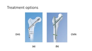 Treatment options
DHS CMN
 