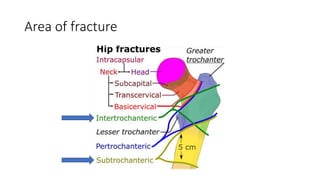 Area of fracture
 