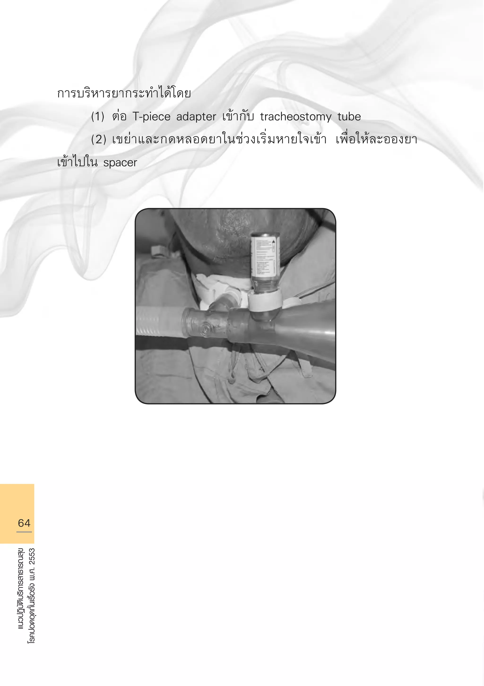 64
แนวปฏิบัติบริการสาธารณสุข
โรคปอดอุดกั้นเรื้อรังพ.ศ.2553
การบริหารยากระทำได้โดย 
	 (1)	ต่อ T-piece adapter เข้ากับ tracheostomy tube 
	 (2)	เขย่าและกดหลอดยาในช่วงเริ่มหายใจเข้า เพื่อให้ละอองยา
เข้าไปใน spacer 

AW HSPG 1 C.indd 64 10/26/10 7:36:01 PM
 