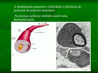 A mielinização aumenta a velocidade e eficiência do potencial de ação nos neurônios. Na doença esclerose múltipla ocorre uma desmielinização. 