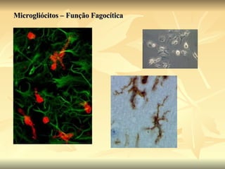Microgliócitos – Função Fagocítica 