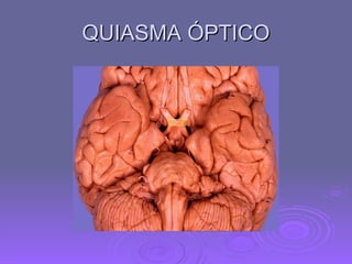 QUIASMA ÓPTICO 