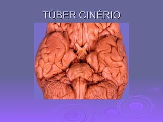 TÚBER CINÉRIO 
