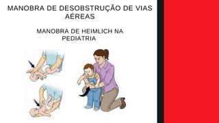MANOBRA DE DESOBSTRUÇÃO DE VIAS
AÉREAS​
MANOBRA DE HEIMLICH NA
PEDIATRIA
 