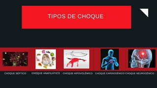 CHOQUE NEUROGÊNICO
CHOQUE CARDIOGÊNICO
CHOQUE HIPOVOLÊMICO
CHOQUE SÉPTICO
TIPOS DE CHOQUE
CHOQUE ANAFILÁTICO
 