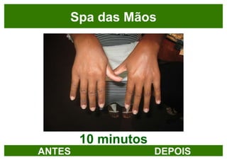 10 minutos Spa das Mãos ANTES DEPOIS 