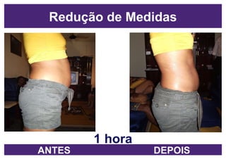 1 hora Redução de Medidas ANTES DEPOIS 