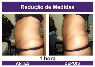 1 hora Redução de Medidas ANTES DEPOIS 