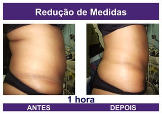 1 hora Redução de Medidas ANTES DEPOIS 