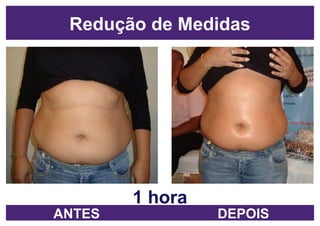 1 hora Redução de Medidas ANTES DEPOIS 