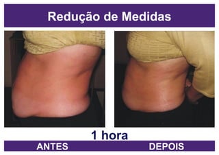 1 hora Redução de Medidas ANTES DEPOIS 