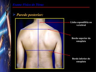 Exame Físico do Tórax


 Parede posterior:
                        Linha espondiléia ou
                             vertebral




                         Borda superior da
                             omoplata




                         Bordo inferior do
                            omoplata
 