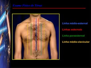 Exame Físico do Tórax




                        Linha médio-esternal

                        Linhas esternais

                        Linha paraesternal

                        Linha médio-clavicular
 