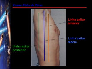 Exame Físico do Tórax



                        Linha axilar
                        anterior



                        Linha axilar
                        média
Linha axilar
posterior
 