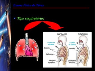 Exame Físico do Tórax



 Tipo respiratório:
 
