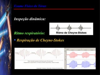 Exame Físico do Tórax


Inspeção dinâmica:


Ritmo respiratório:
 Respiração de Cheyne-Stokes
 