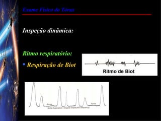 Exame Físico do Tórax


Inspeção dinâmica:


Ritmo respiratório:
 Respiração de Biot
 