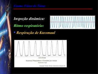 Exame Físico do Tórax


Inspeção dinâmica:
Ritmo respiratório:
 Respiração de Kussmaul
 