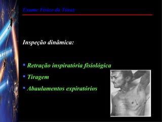 Exame Físico do Tórax




Inspeção dinâmica:


 Retração inspiratória fisiológica
 Tiragem
 Abaulamentos expiratórios
 
