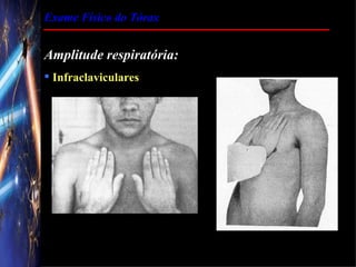 Exame Físico do Tórax


Amplitude respiratória:
 Infraclaviculares
 