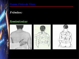 Exame Físico do Tórax


Frêmitos:

Semiotécnica:
 