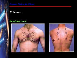 Exame Físico do Tórax


Frêmitos:

Semiotécnica:
 