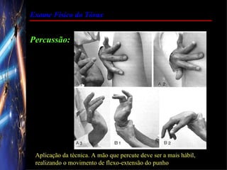 Exame Físico do Tórax


Percussão:




 Aplicação da técnica. A mão que percute deve ser a mais hábil,
 realizando o movimento de flexo-extensão do punho
 