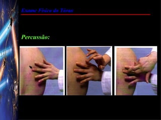 Exame Físico do Tórax




Percussão:
 